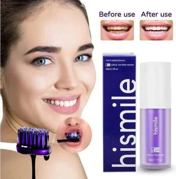 teeth whitner